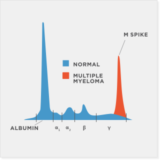 What is M-Spike (Urine)?
